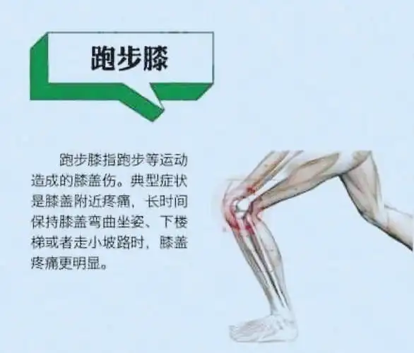 胫前疼痛,跟腱炎,足底筋膜炎,这些名称你可能不熟悉,但跑步后膝盖疼
