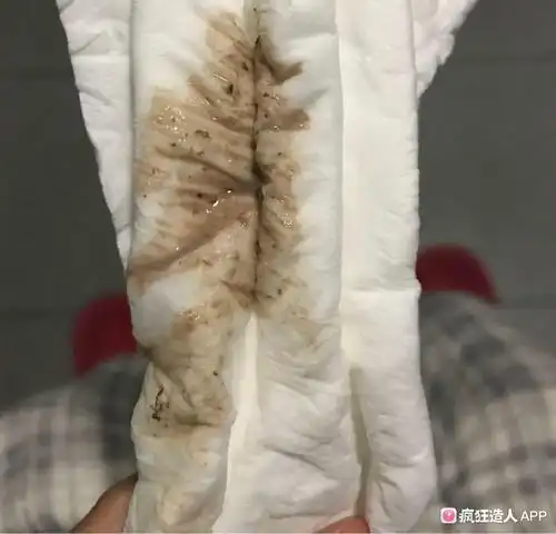 有图慎点!褐色分泌物