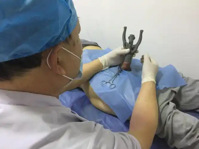 发表者:方学贵17327人已读一次性包皮环切缝合器手术图