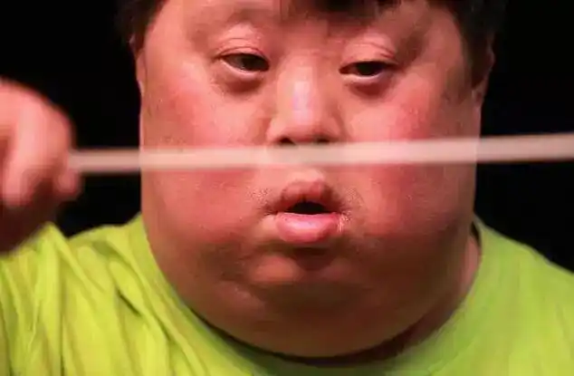 为什么会出现先天愚型