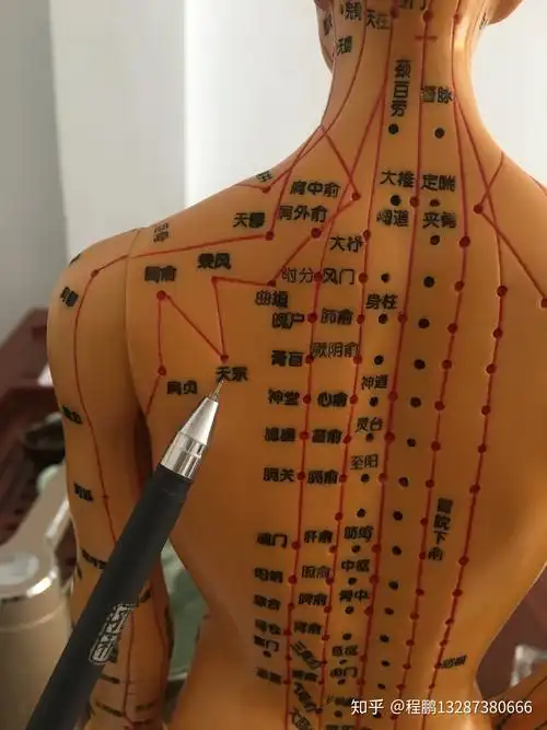 方法:患侧乳房相对应的部位涂刮痧油滑罐,待出痧后,在痧斑上留罐,罐体