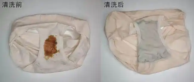 内裤上出现这些分泌物,你可能有隐形的妇科疾病!