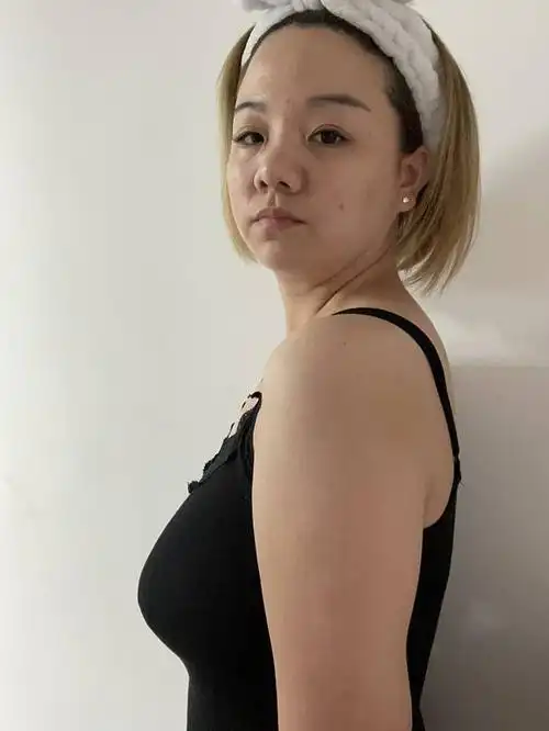 生完孩子后加哺乳胸部就严重下垂了.形状真的不_圈子-新氧美容整形
