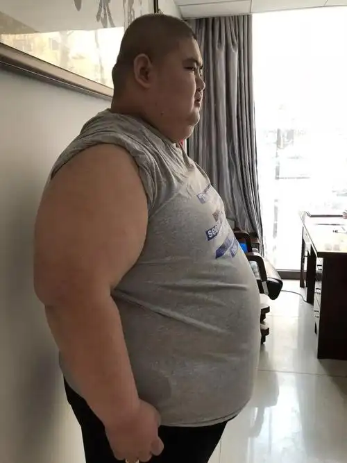 谁说冬天就长胖25岁胖小伙儿8个月减重135斤