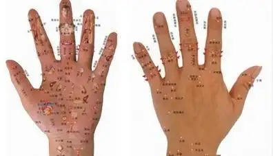 左手食指上有痣左手食指上有痣说明什么
