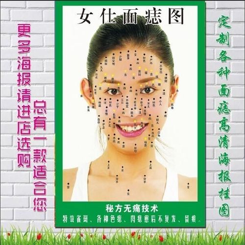 高清女士面痣图点痣图祛痣写真海报除痣挂图面相墙贴广告宣传画面