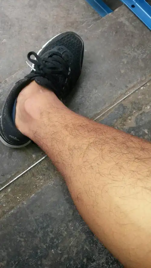 因为腿毛太多了是什么梗