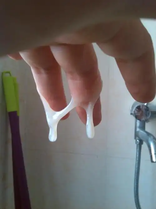 请问白带胶状条形像活动是排卵钱,还是排卵后?