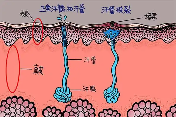 你不知道的人体小秘密汗腺