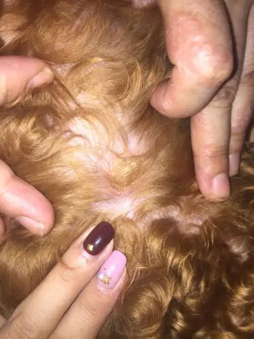 狗狗身上长了一块小癣,麻烦看看有没有知道是什么?