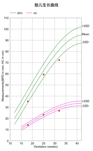 胎儿医学计算器