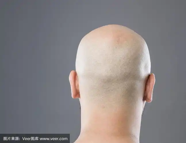 光头的后视图