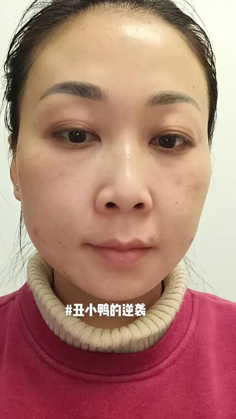 图文伙伴计划 以前长得丑,不太好意思发自拍.现在我不一样了 - 抖音