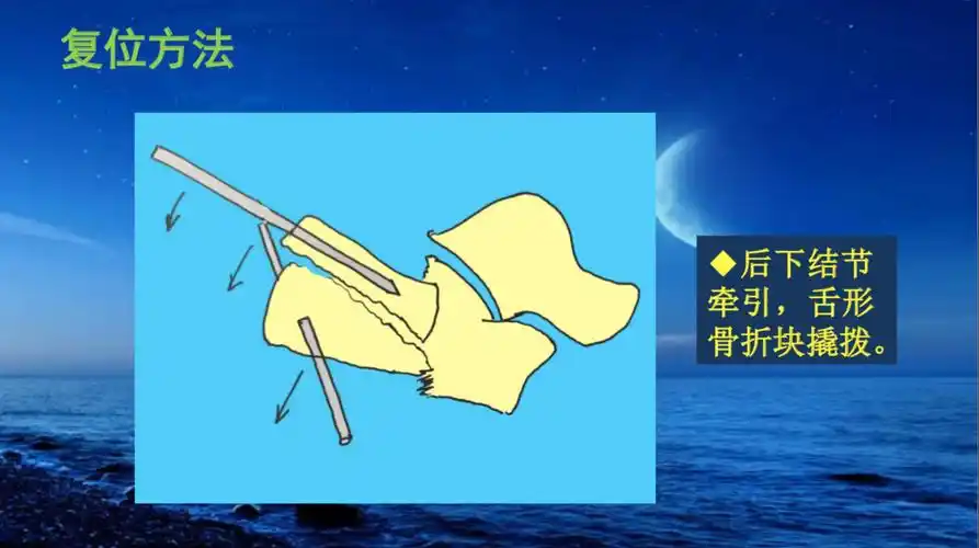 看完这篇你就会啦