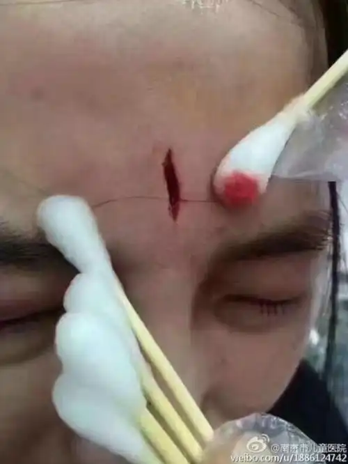 护士静脉穿刺未一次成功,遭患儿家属ipad砸穿头