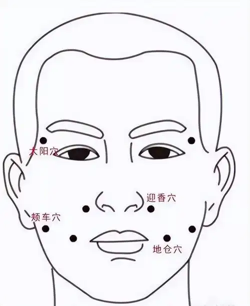 巧用三棱针治面瘫