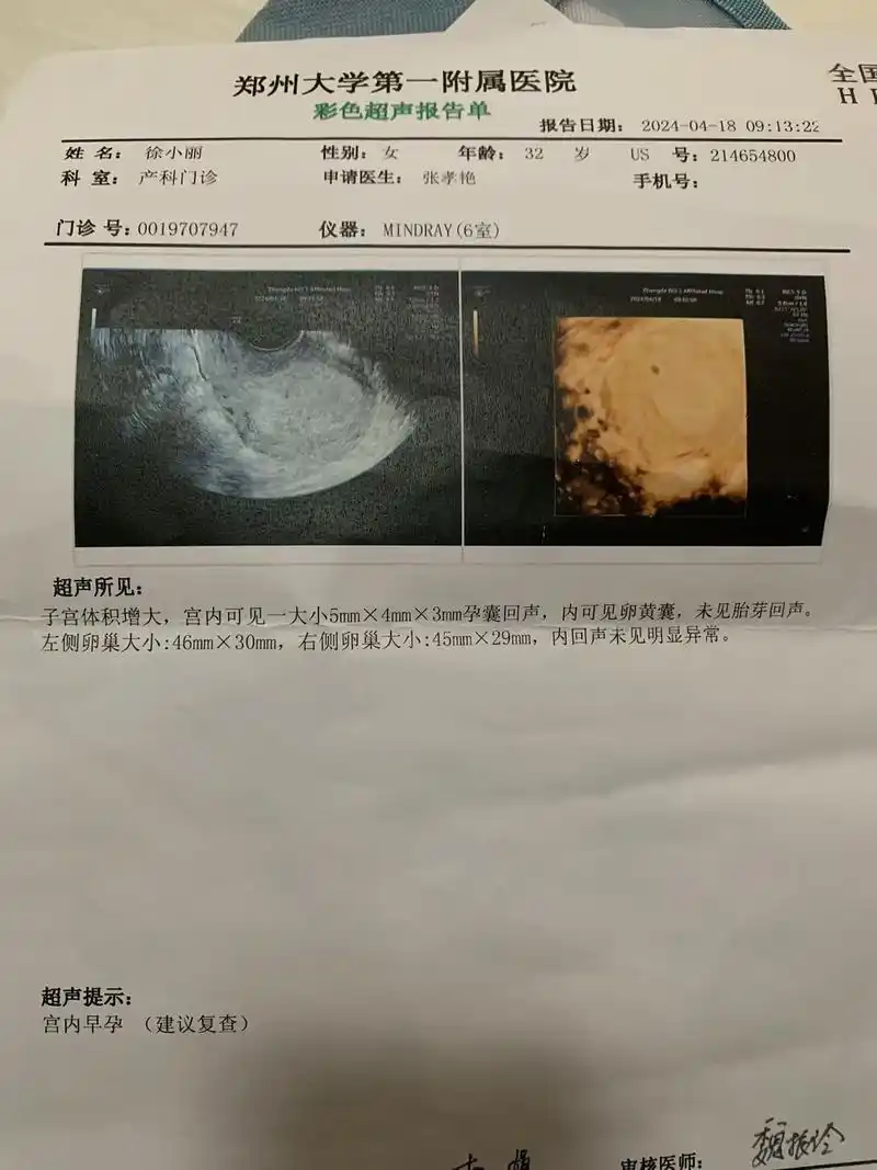 移植28天hcg4463.从发现怀孕开始,没有一天是开心的# - 抖音