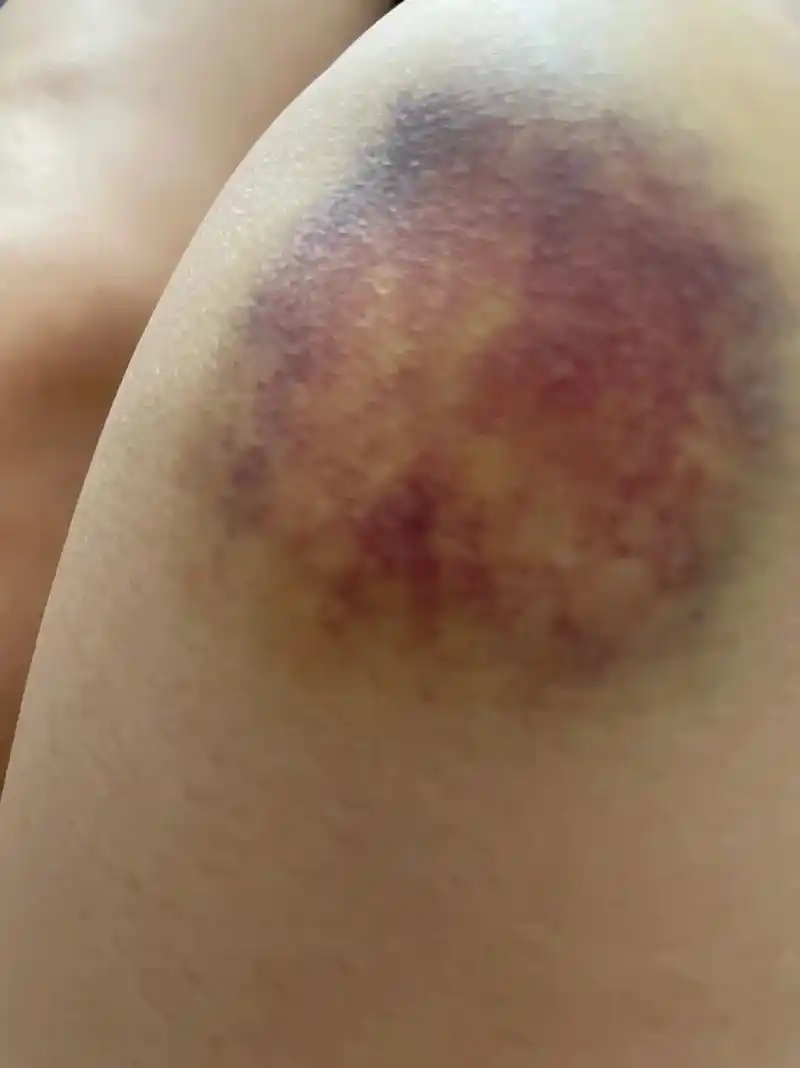 有的路不走,不甘心,走了,满身伤痕,人生就是这样,无论怎么选 - 抖音