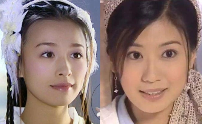 美人在骨不在皮张庭真正的美貌实力一直被一个区区的酒窝掩盖了