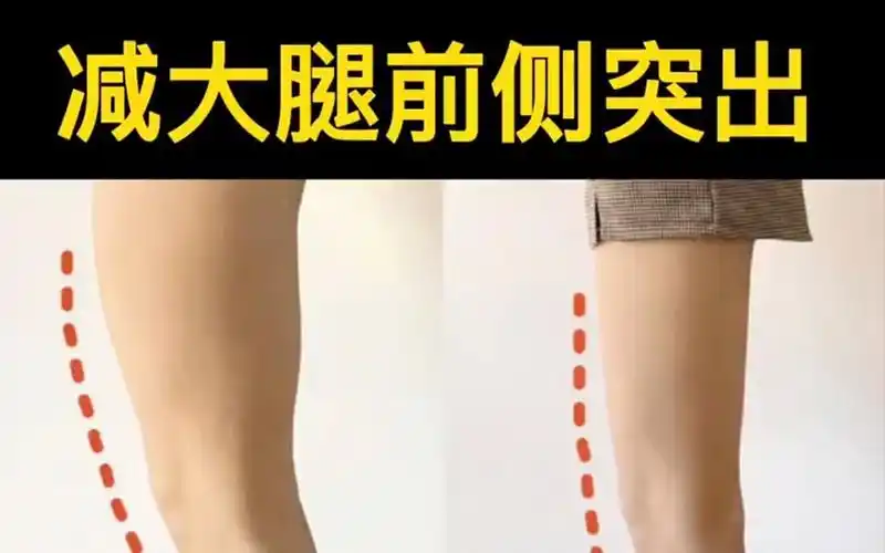 大腿前侧突出有救了