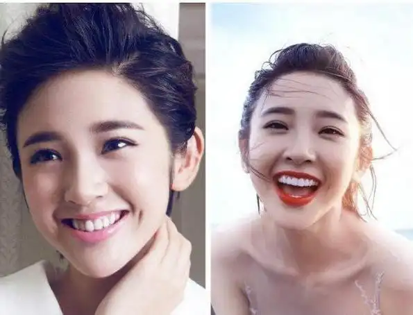 明星烤瓷牙太不真实了镜头下反光牙缝发黑直接没眼看