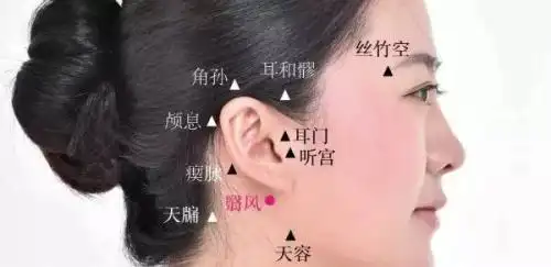 面瘫艾灸疗法治疗