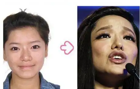 从比赛时情的照片来看,江映蓉的面部确实有很大的改变,从以前的土肥圆