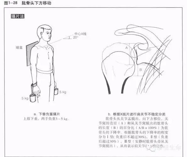 肩关节x线检查体位大全