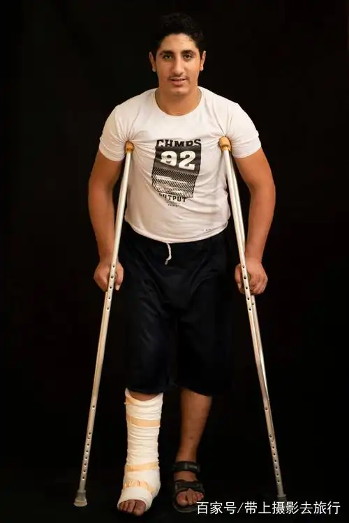 巴勒斯坦之殇:加沙街头随处可见撑拐杖的年轻人