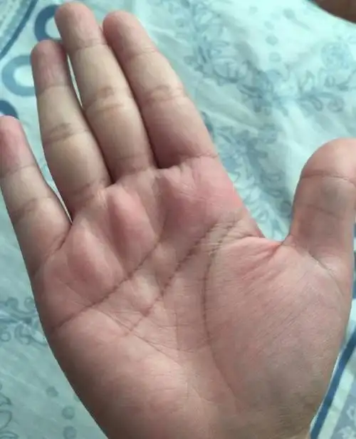 (女,阳历1985年5月9日,早晨7点出生)智慧线有断开,感情方面也是分叉多