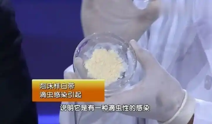 警惕出现这5种状肼砩暇鸵