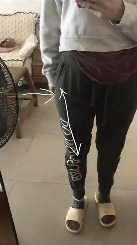 为什么大腿根部这里突出来骨头 有救吗呜呜呜