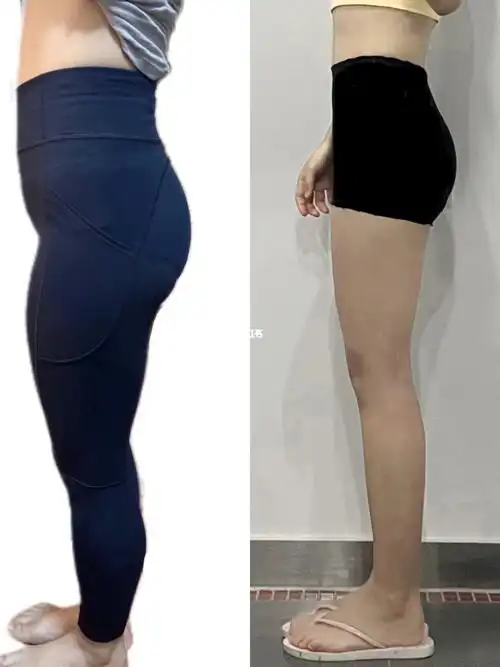 臀部和大腿后侧肌肉46615髂腰肌和大腿前侧拉伸99有效改善大腿