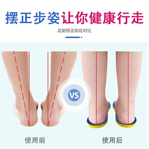 成人o型腿足内翻膝内翻矫正罗圈腿内外八字外侧受力平衡塑形鞋垫