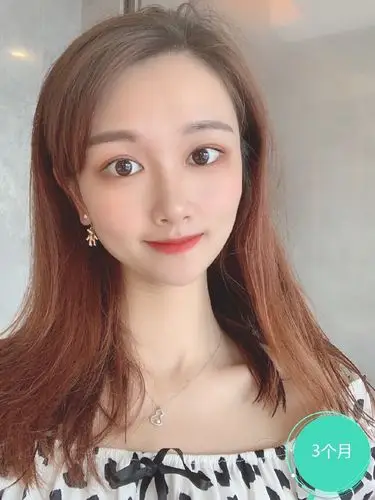 我的鼻子确实比较塌,所以每次发朋友圈自拍照都要考虑再三,一直在犹豫