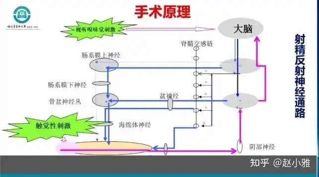 为了延时,阴茎背神经阻断术值不值得做?救命稻草还是治疗陷阱?