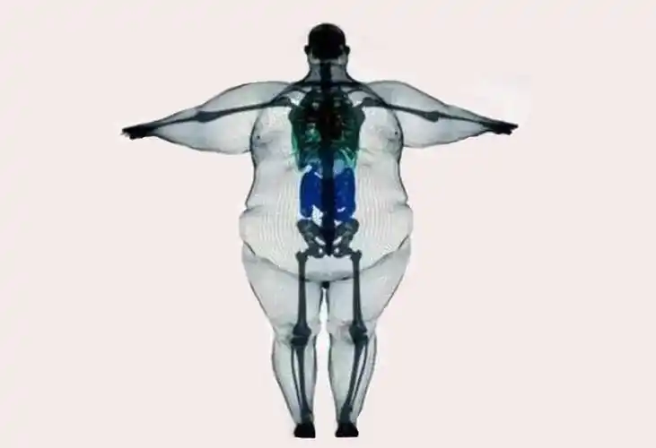 骨架大也能瘦?抱歉现在才告诉你!