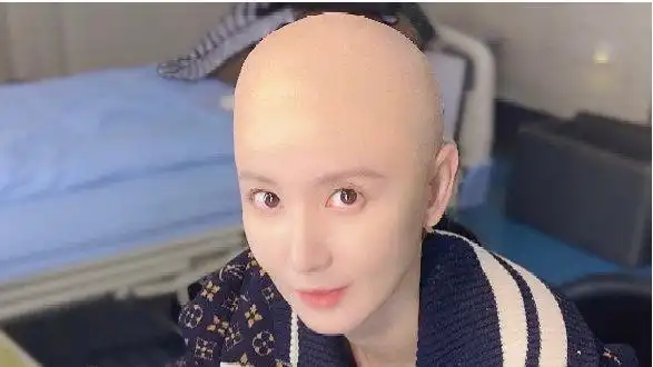 40岁张萌晒素颜照,剃光头在病房吃面露病号服?疑患病未住单间