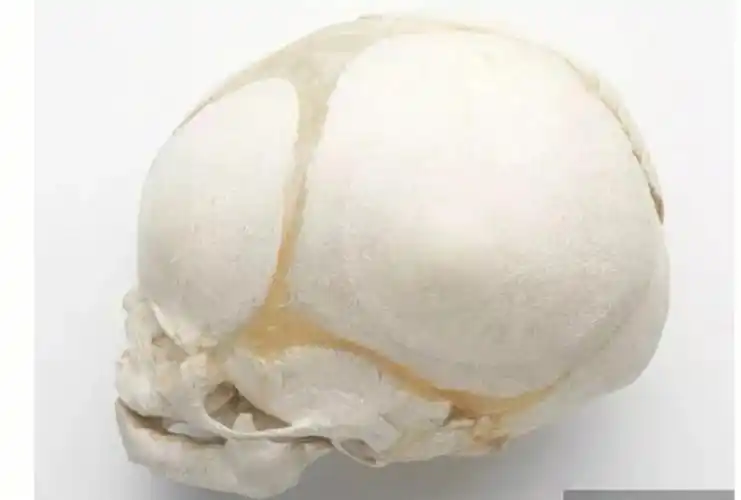 颅骨由多个颅骨片组成,对于新生儿来说,为了顺利的从妈妈产道娩出