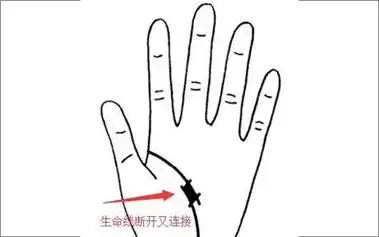 你要知道的生命线断开的几个解释