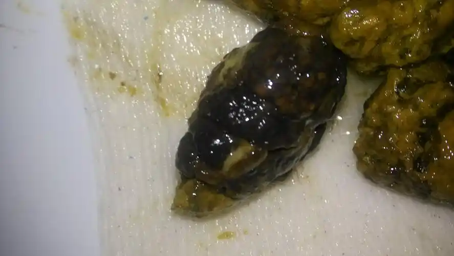 这样大便跟喝了凉茶有没有关系,还有白色油脂物