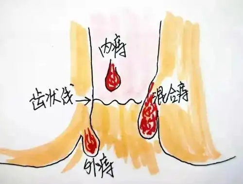 大石桥痔疮看的好的医院-营口站前同济医院有限公司