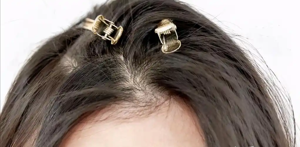 头发很贴很重很塌的人怎么让头顶看起来蓬松?