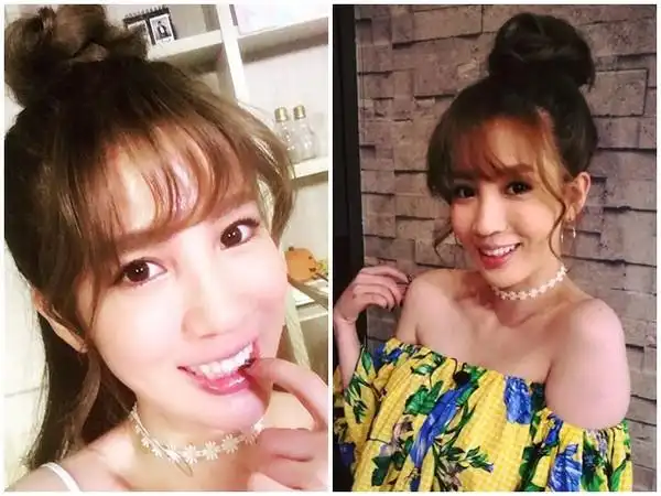 张艾亚正颚5年后转运 「月收入翻涨100倍」看千万豪宅