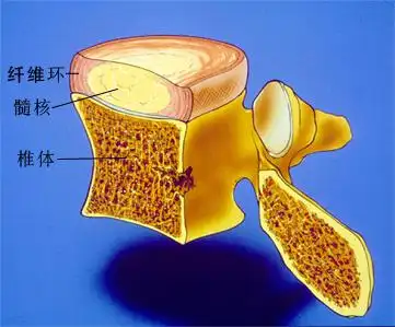 腰椎间盘由透明软骨(也叫软骨终板),纤维环和髓核三部分构成,纤维环由