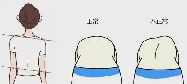 什么是"剃刀背"?