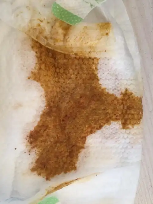 各位宝妈帮看看宝宝35天,大便里有红色东西,母乳喂养,这是为什么