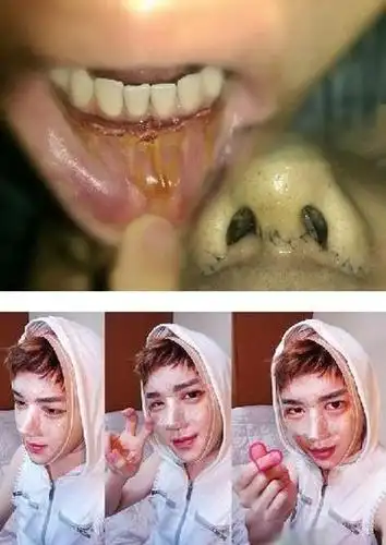 韩国男生的整容史 丑大叔变花美男