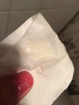 谁能告诉我这到底怎麼回事啊,小肚子疼,流出来的像酸奶一样,好害怕