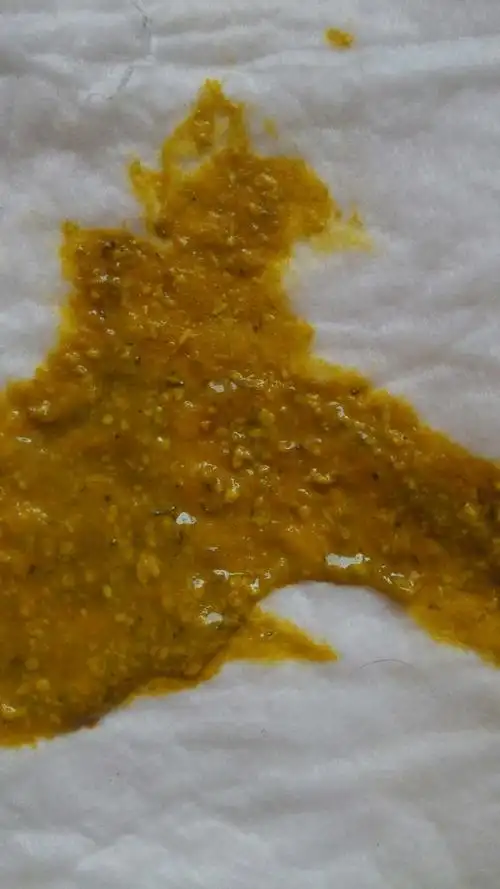 虽然很恶心,我确实太害怕了但是宝妈们还是给看下吧怎么都是黑色的